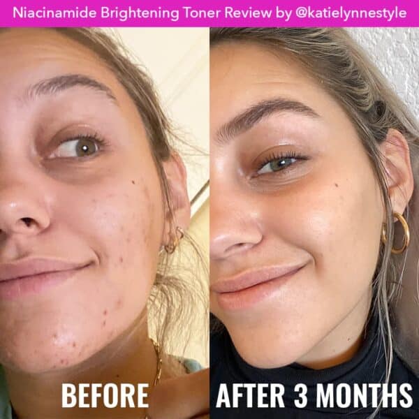 Niacinamide Brightening Toner - Imagen 2